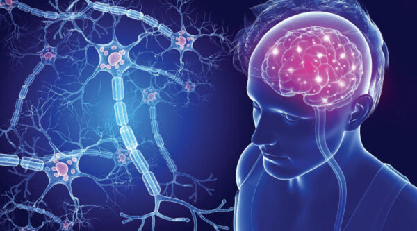 Multiple Sclerosis